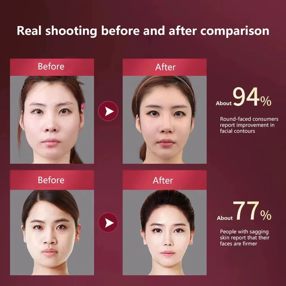 Mascarilla facial reafirmante con vibración EMS y efecto lifting